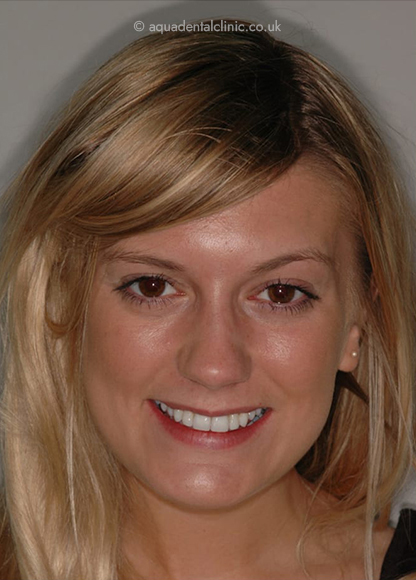 Full Face