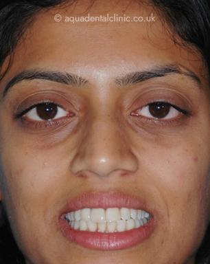 Full Face