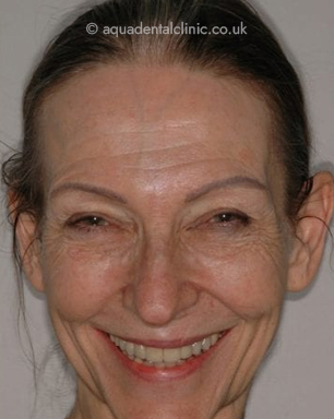 Full Face