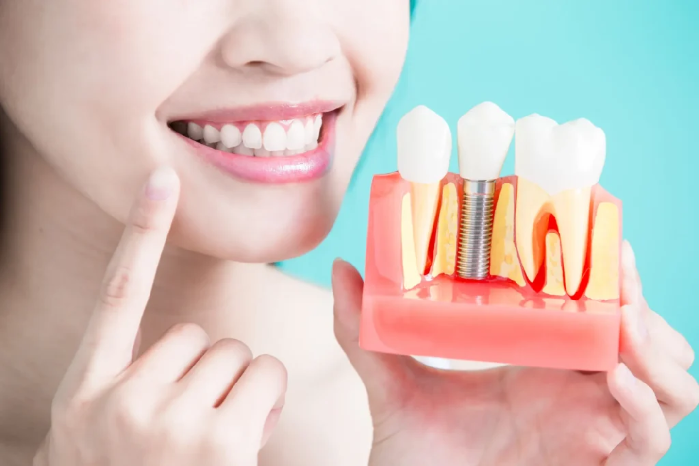 Young Asian woman smiling holding dental implant model