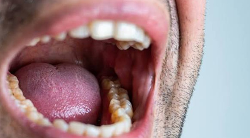 metallic taste in mouth