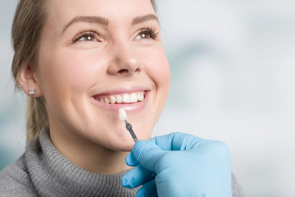 Porcelain Veneers