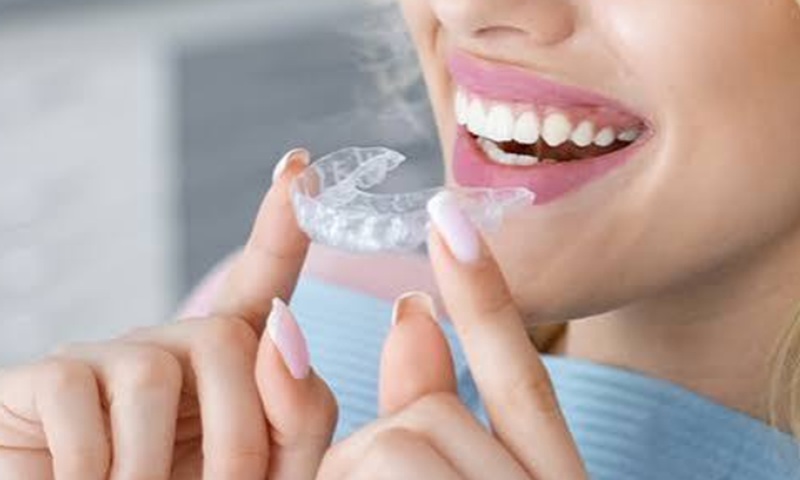 Invisalign img